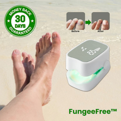 PrevaZen™ - Nail Fungus Laser