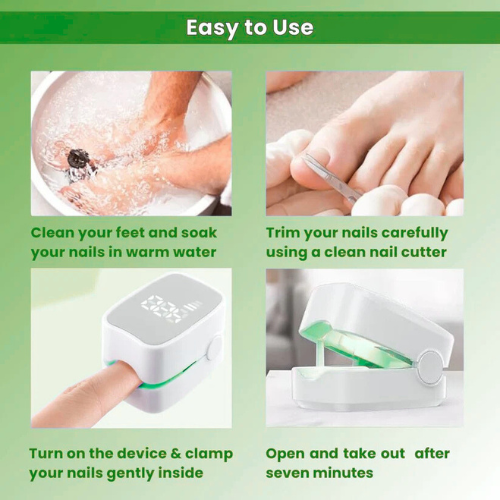 PrevaZen™ - Nail Fungus Laser